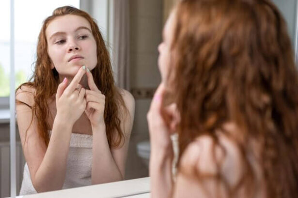 Prevent Acne Breakouts