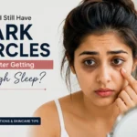 Why Do I Still Have Dark Circles After Sleeping